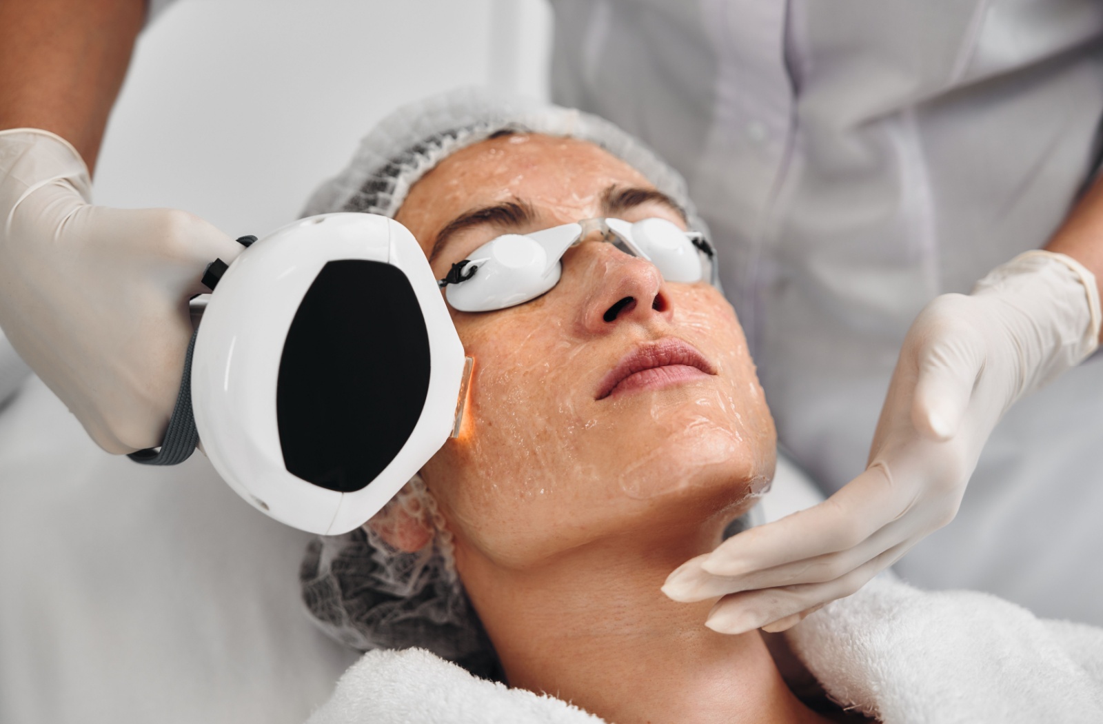 A person using IPL for skin concerns.